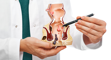 International Updates In Hemorrhoidal And Fissure Treatment