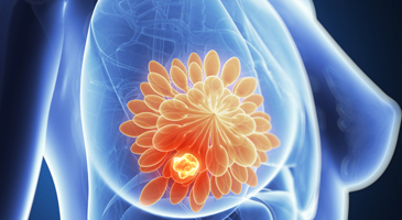 Interdisciplinary approach to breast cancer - Newest developments