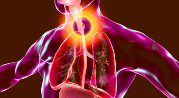 Evaluation and management of a patient with tracheostomy and dysphagia 